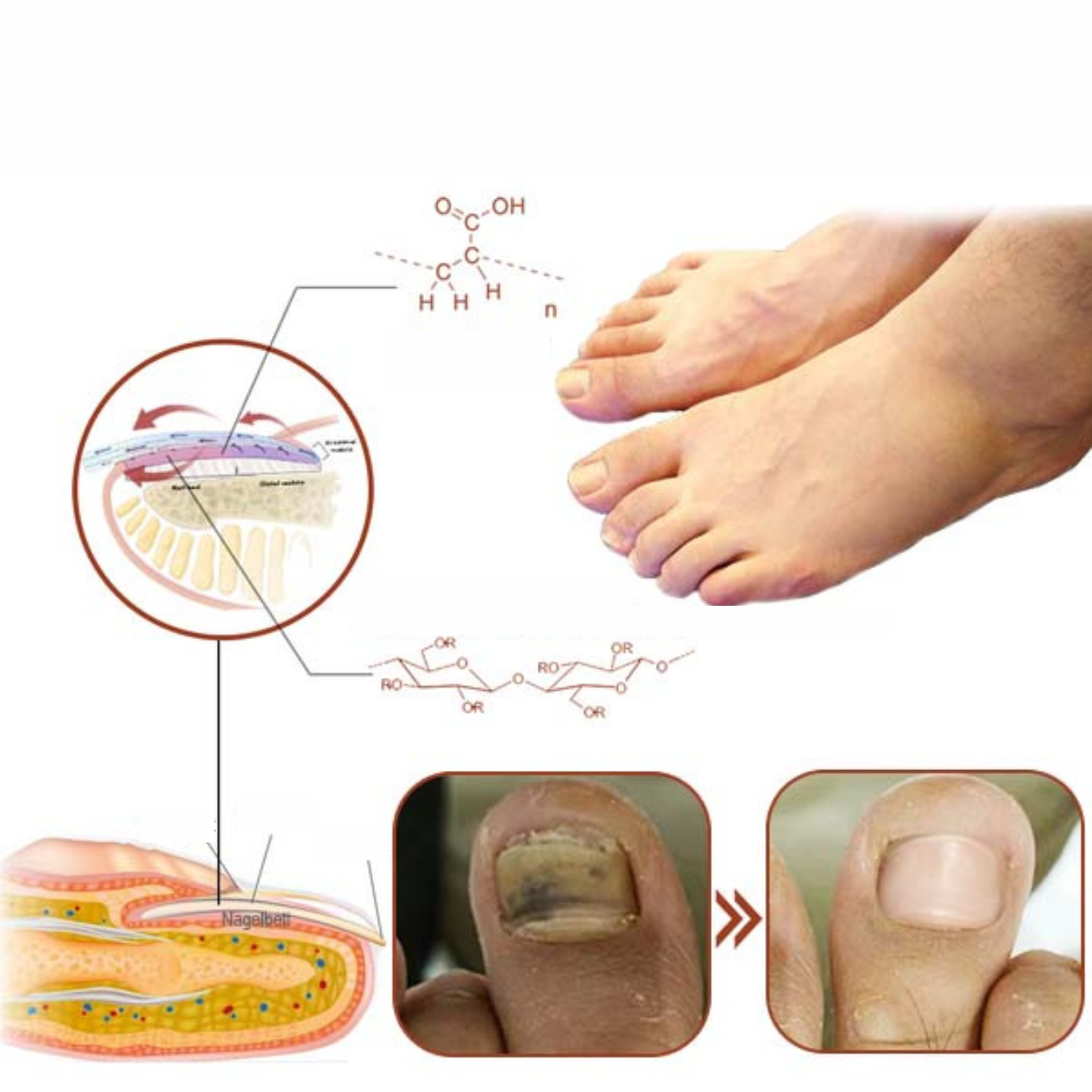 LumiNail - Zichtbaar gezonde nagels zonder chemicaliën!