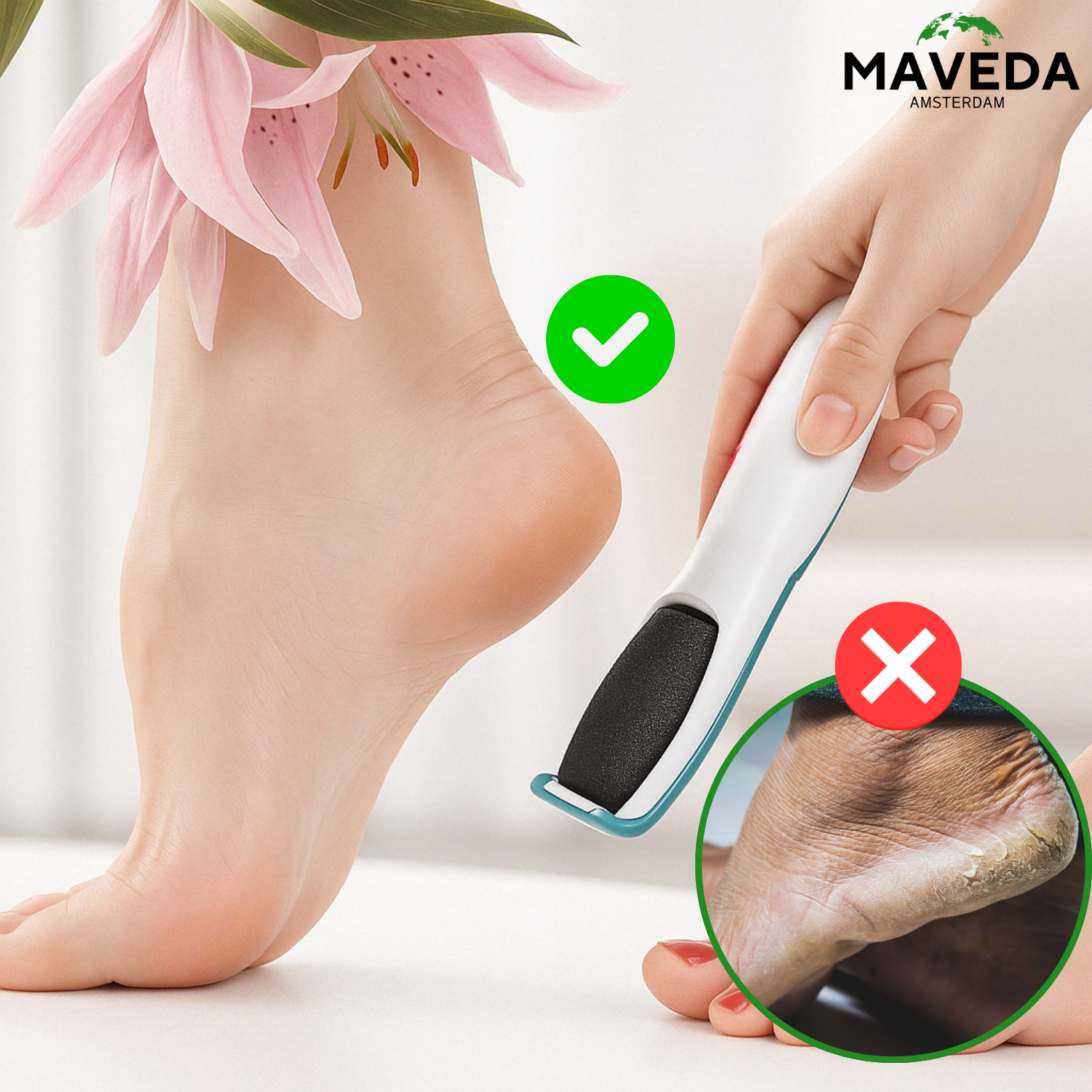 SilkaFeet™ - Moeiteloos gladde en verzorgde voeten