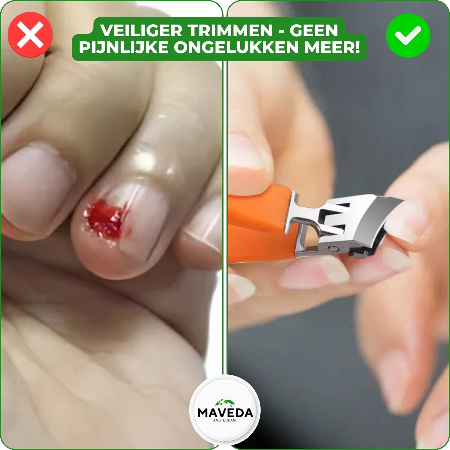 WideTrim™ - Wijd openende, spatwaterdichte, schuine nagelknipper