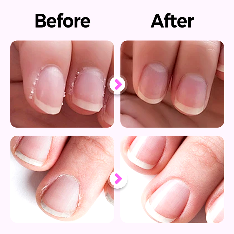 3-in-1 Nagelverzorgingspen voor Gladde en Glanzende Nagels
