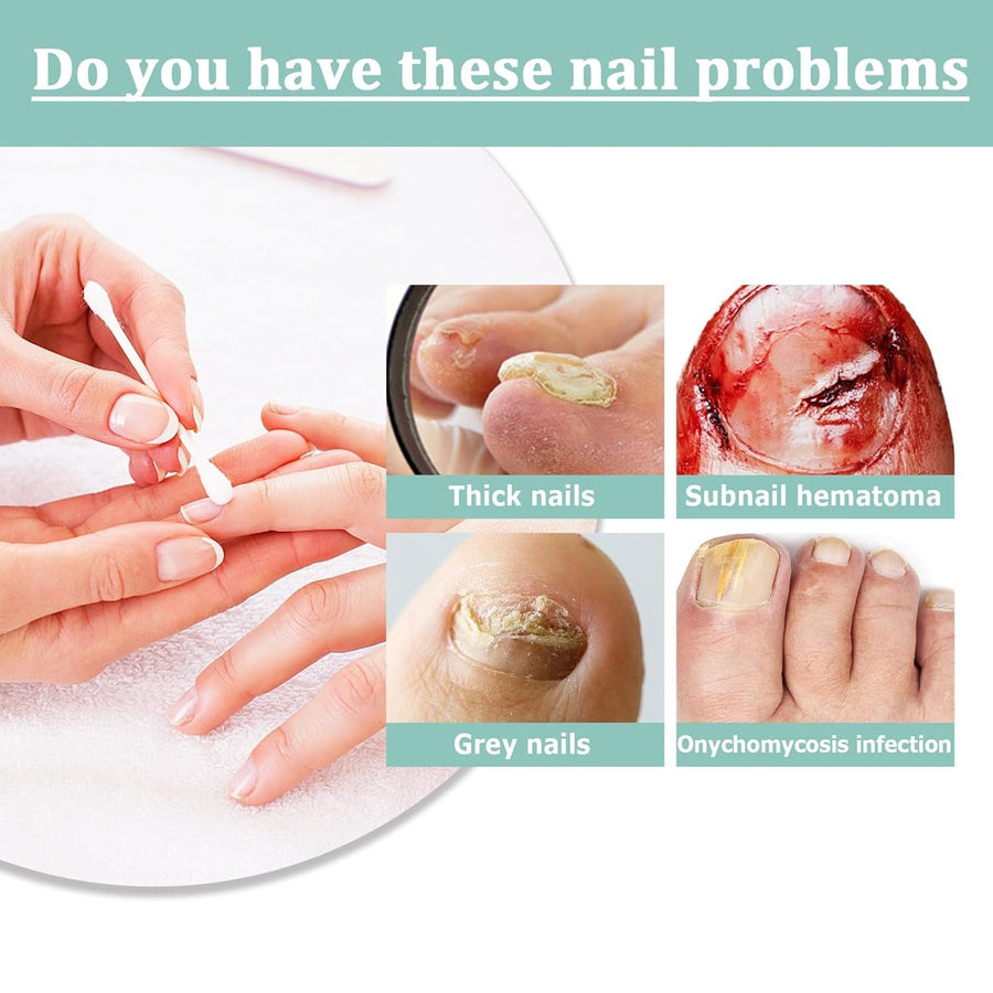 1+1 GRATIS | NailBloom - Zeg voor altijd vaarwel tegen broze nagels
