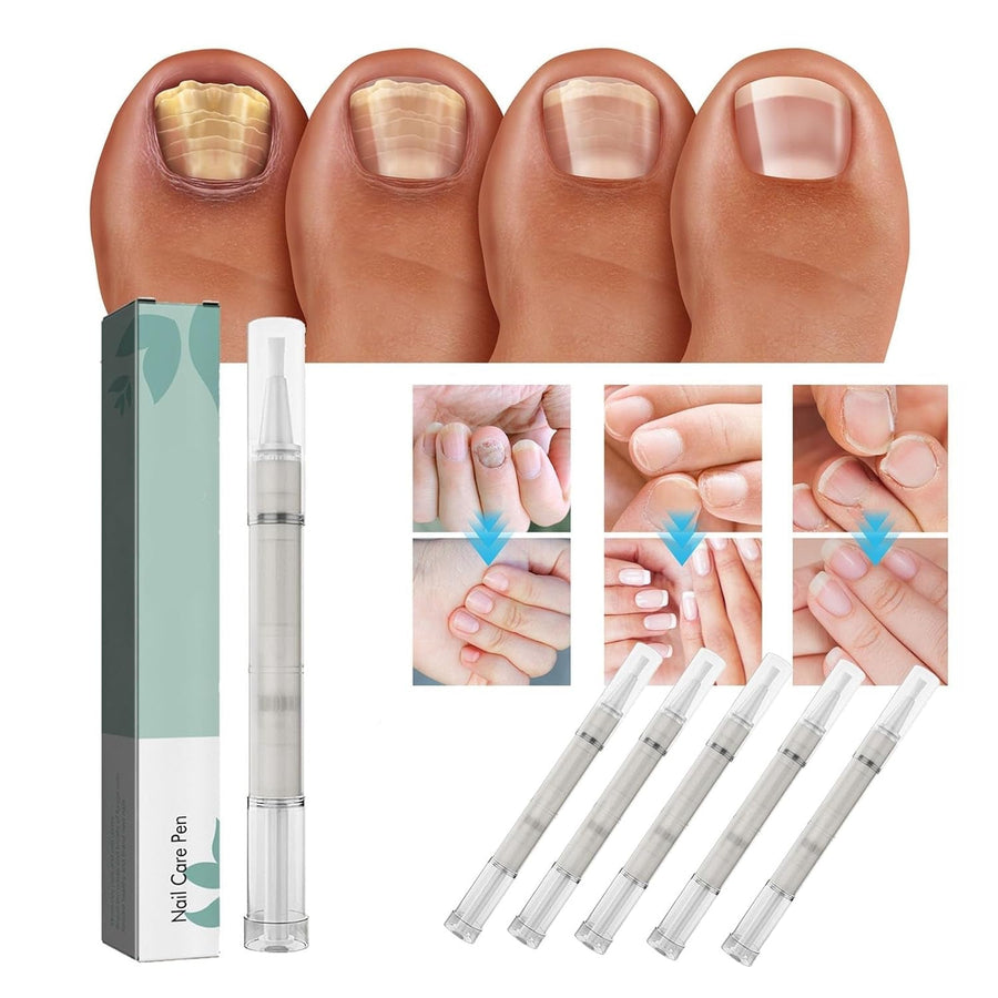 1+1 GRATIS | NailBloom - Zeg voor altijd vaarwel tegen broze nagels