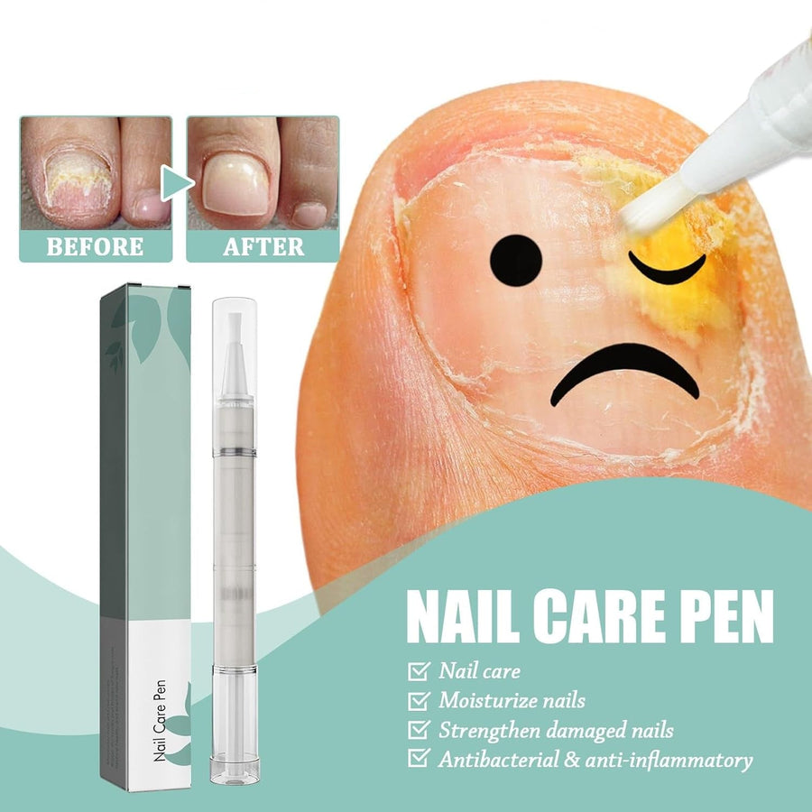 1+1 GRATIS | NailBloom - Zeg voor altijd vaarwel tegen broze nagels