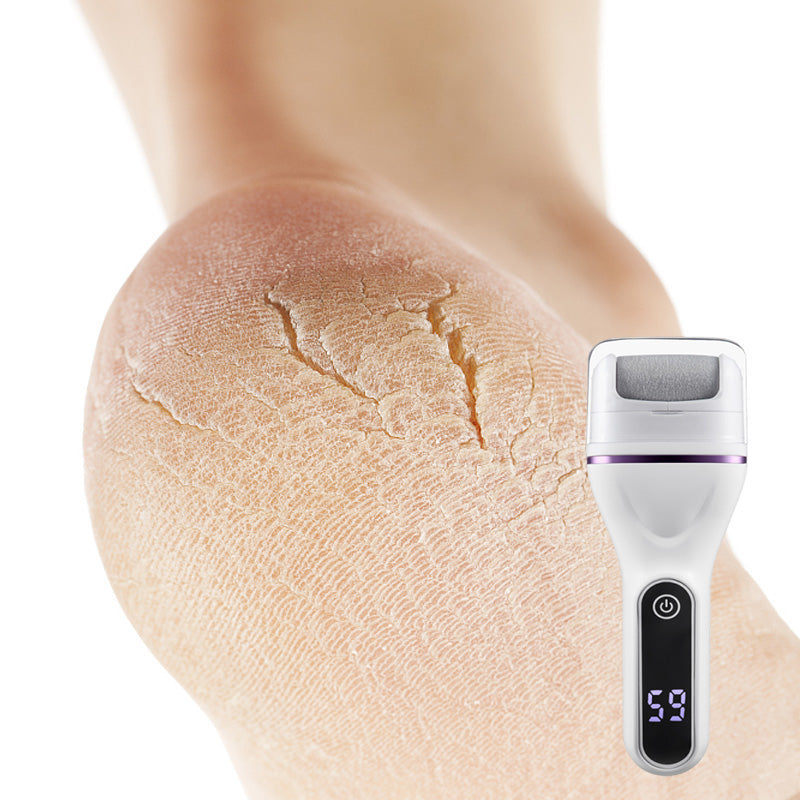 SoftStep Pro - Voor fluweelzachte voeten in enkele minuten